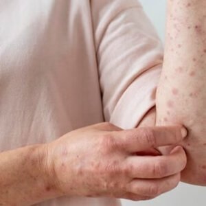 Bacterial skin infection treatment at home